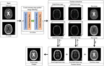 Local extreme map guided multi-modal brain image fusion